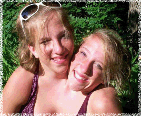 photo Abigail-and-Brittany-Hensel-_zpsd2b05513.gif